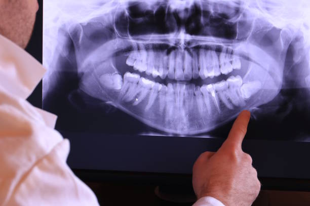 Best Walk-In Emergency Dentist in Arbutus, MD